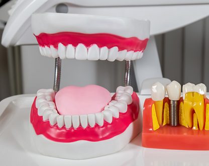 dental implants in boynton beach, dental implants near me, dentist 33426