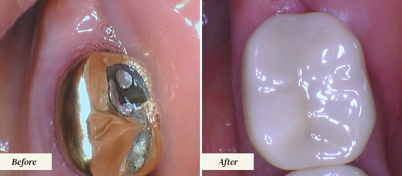 Boynton-Dentist_After-Before