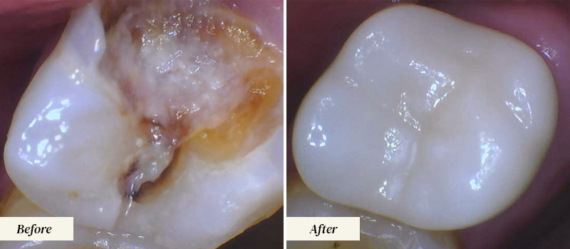 Boynton-Dentist_After-Before