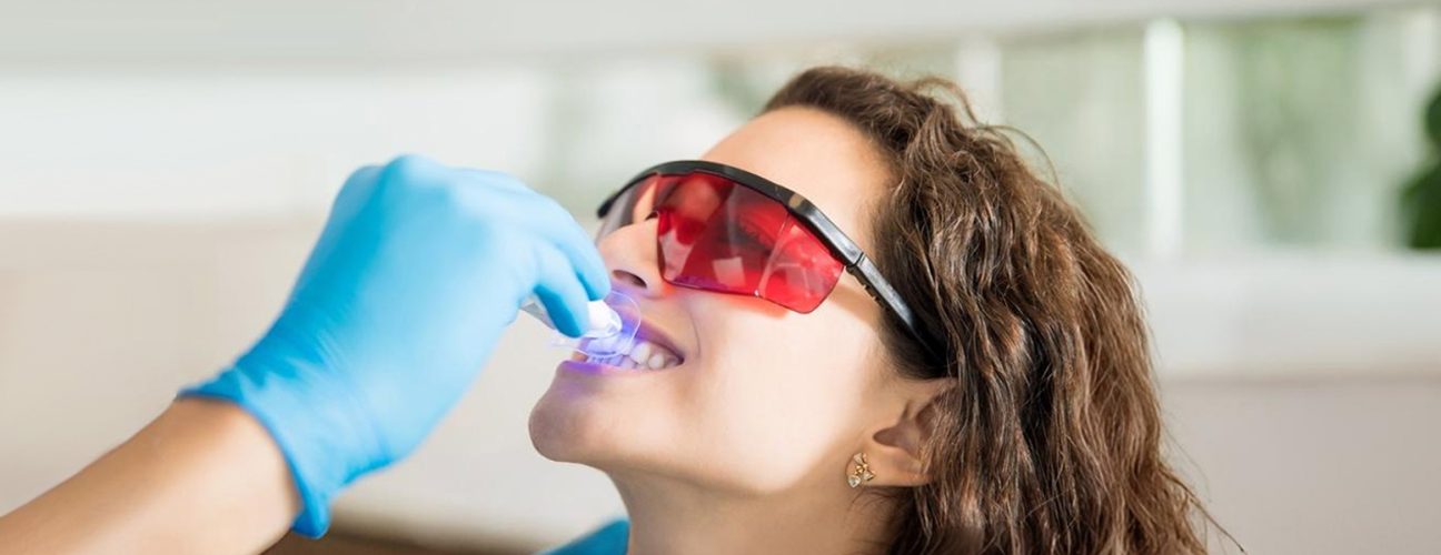 teeth whitening near you