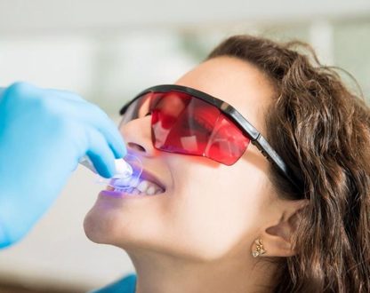 teeth whitening near you